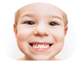 heydents-milchzaehne