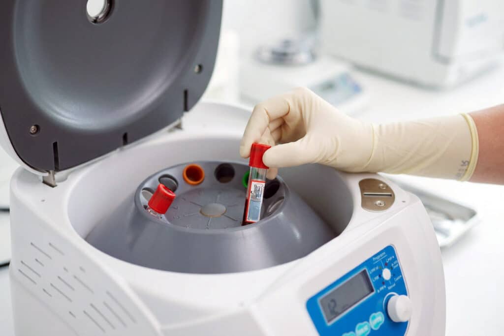 PRF-Zentrifugalmaschine-für-PRF-Behandlung-in-der-Zahnmedizin